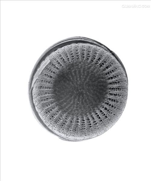 diatom