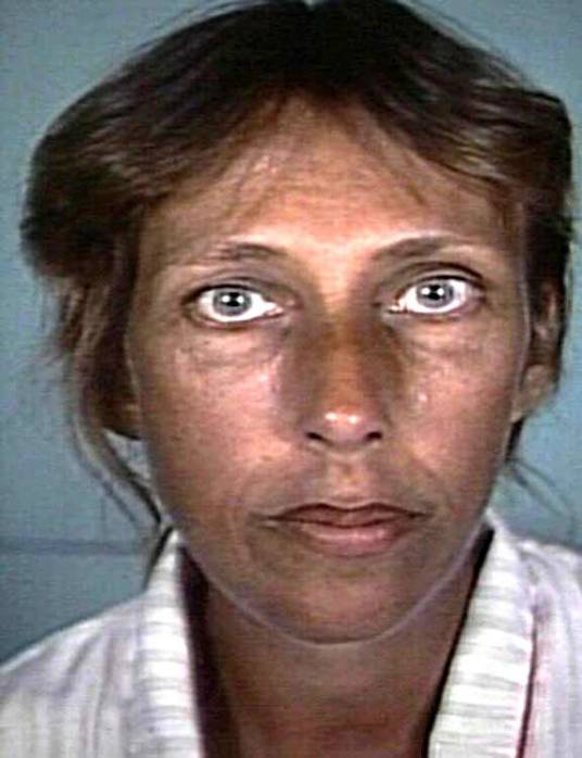 艾迪森氏症_百度百科