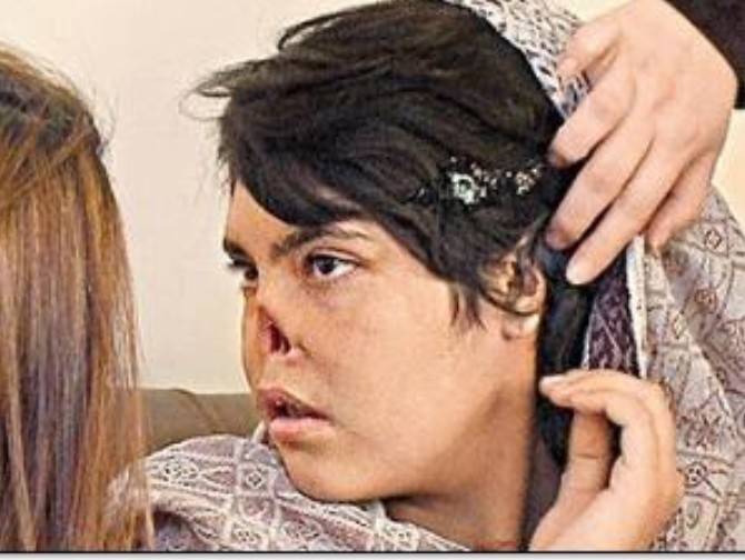  p>阿富汗少女艾莎18岁时不堪忍受家庭暴力而离家出走,竟惨遭丈夫割鼻