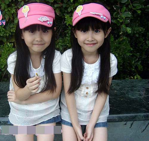 双胞胎一般可分为 a target="_blank" href="/item/同卵双胞胎