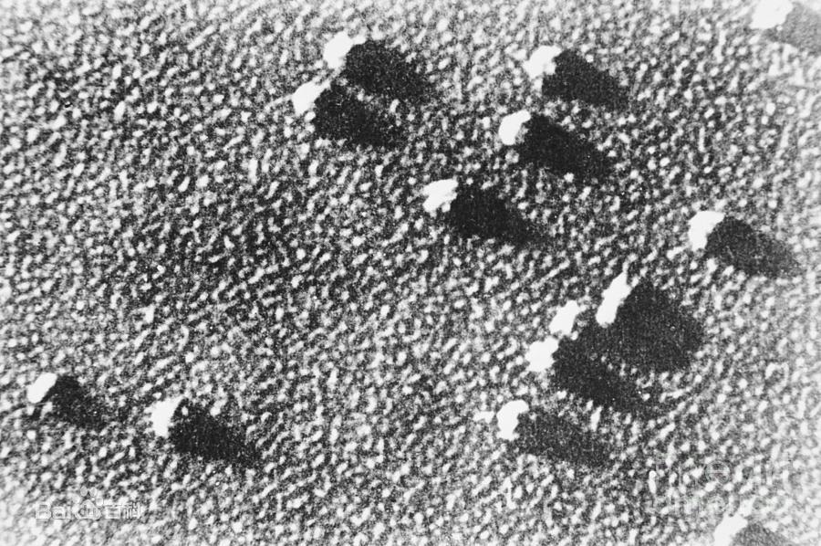  p>核糖体(ribosome),旧称"核糖核蛋白体"或"核蛋白体",普遍被认为是