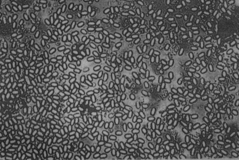 蜜蜂微孢子虫病