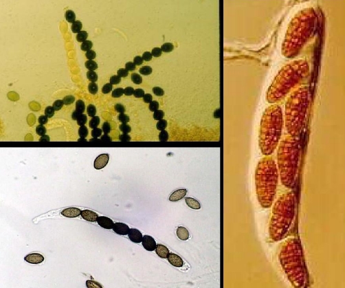 指产生在 a target="_blank" href="/item/子囊菌/1111004" data