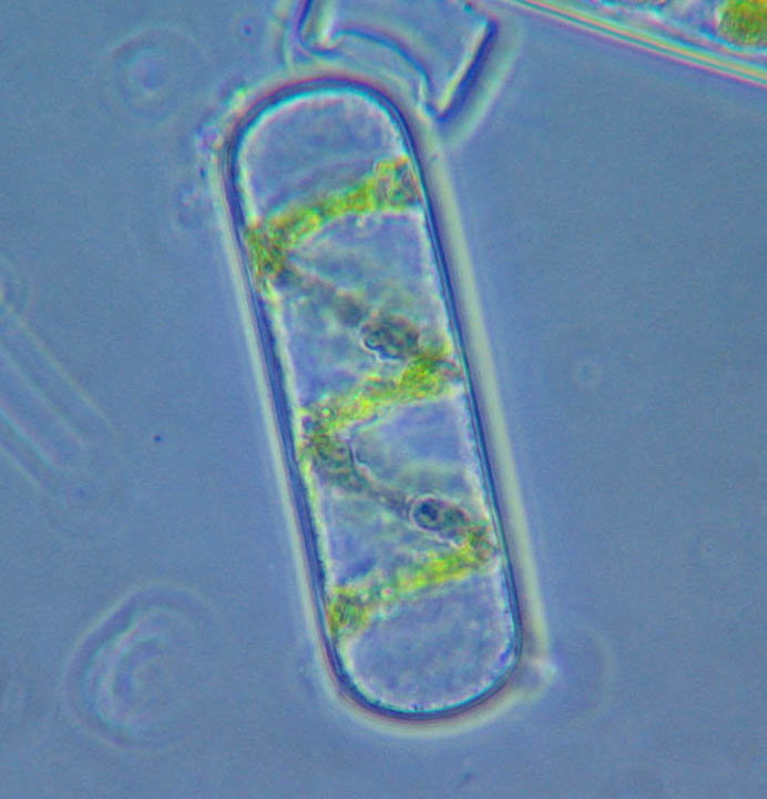  p data-id="gn6ut68eu6">冷性水绵,营养细胞宽17-20微米,长70-300