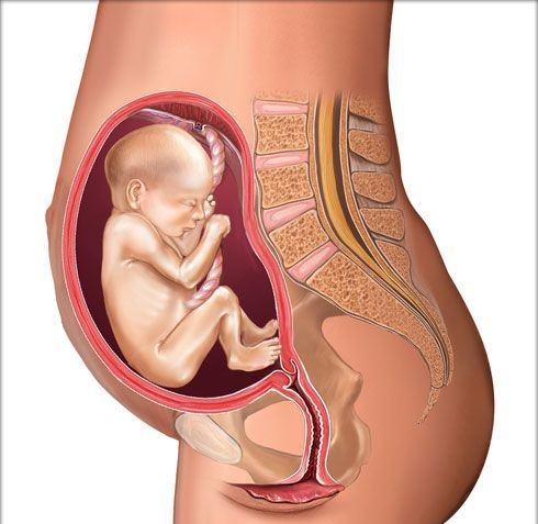 胎位图