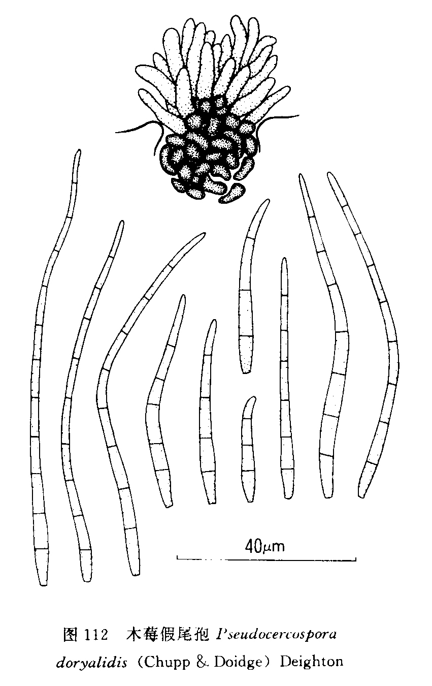 0 mm,有时多斑愈合,叶面斑点灰白色,茶褐色至黑褐色,分生孢子窄倒棍棒