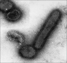 负染色透射电镜 ×175000