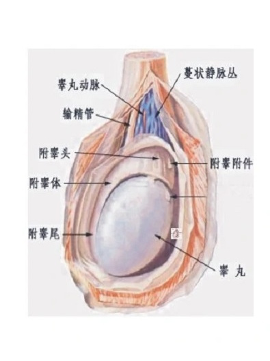 附睾郁积症