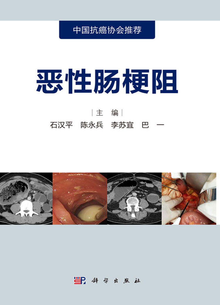恶性肠梗阻