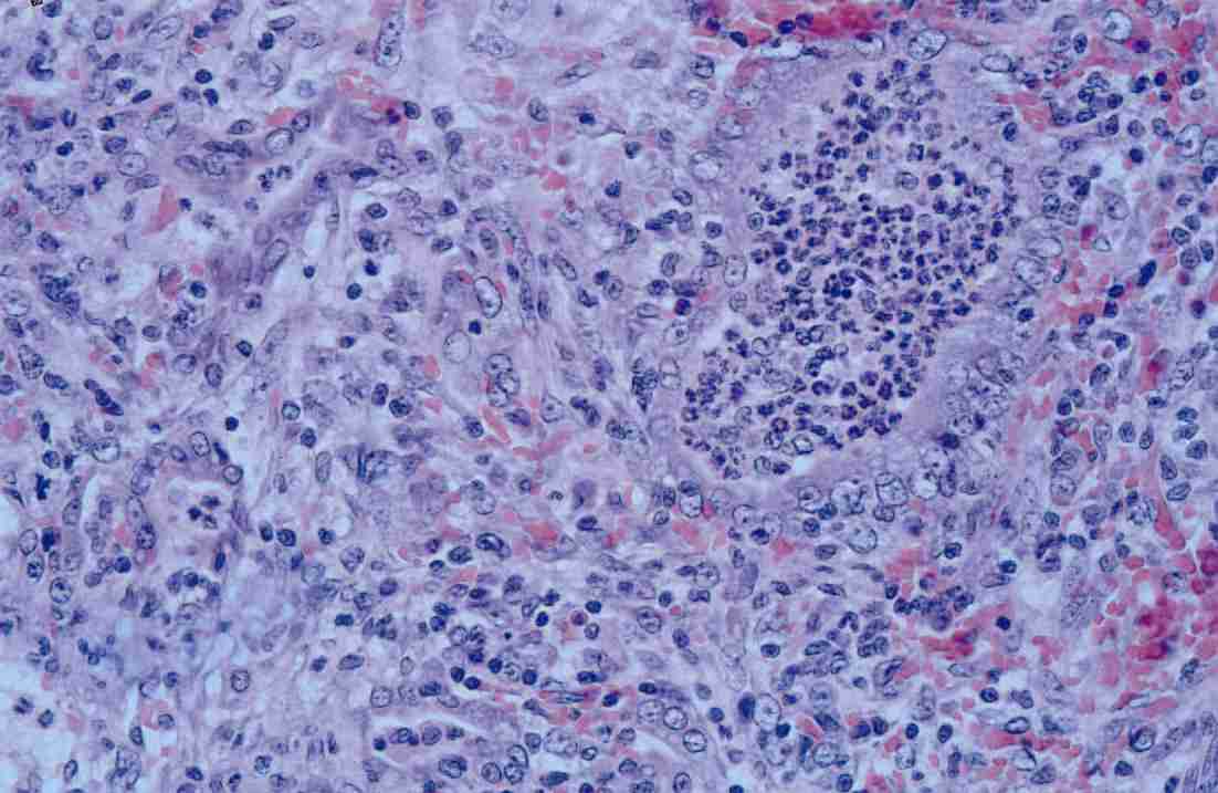  p>仙台病毒亦称hvj(hemagglutinating virus of japan的缩写),乙型副