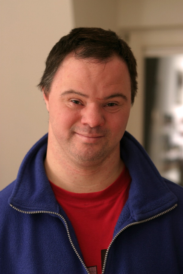 演员,患有 a target="_blank" href="/item/唐氏综合症/1181394" data