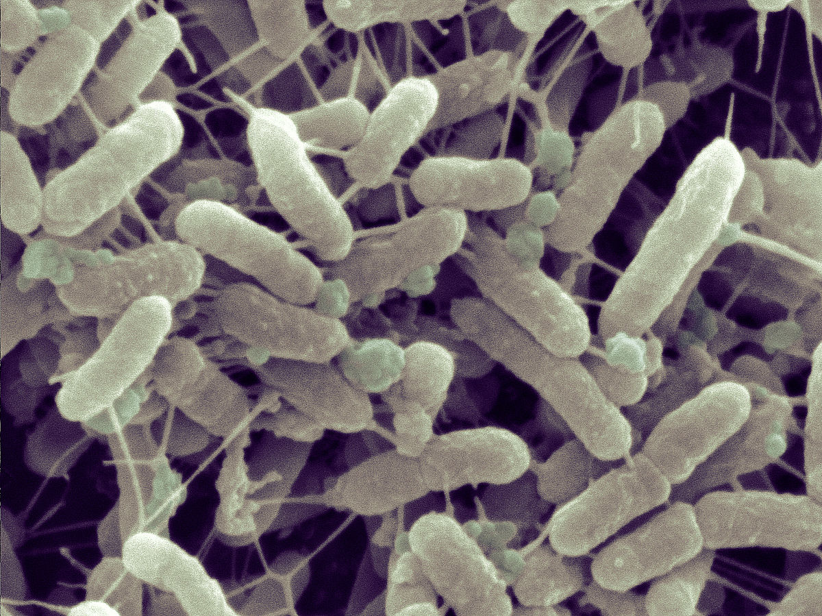 沙雷菌( i>serratia marcescens /i>) 是正常存在于人体中的最小细菌