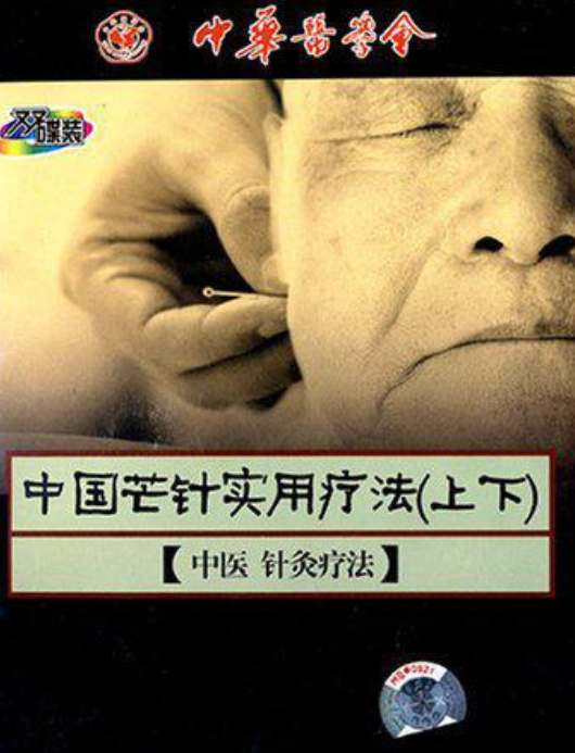 中国芒针实用疗法