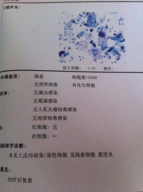 TCT检查_百度百科