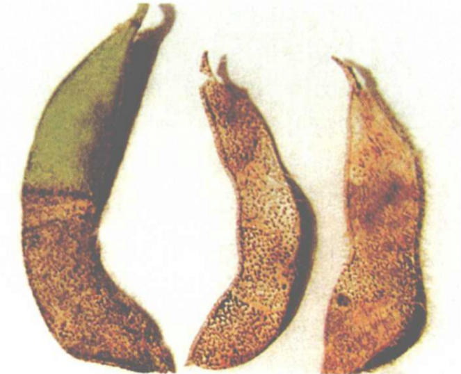大豆轮纹病