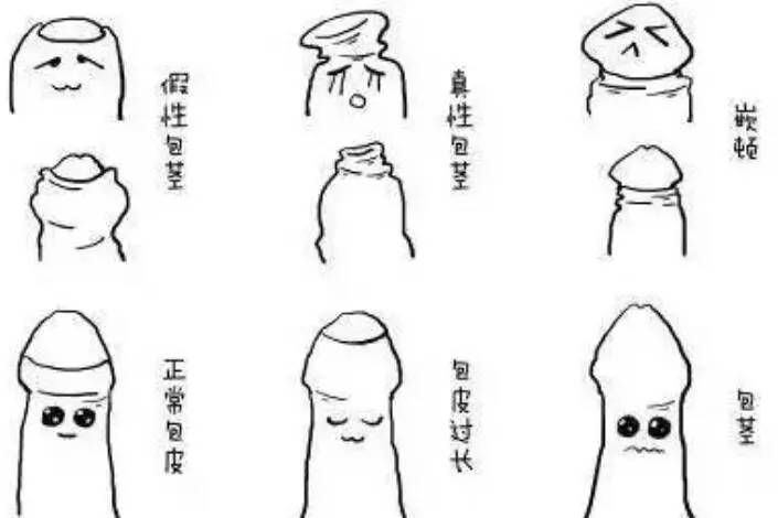  p>假性包皮过长是指平时 a href="#" data-lemmaid="3292627">龟头 