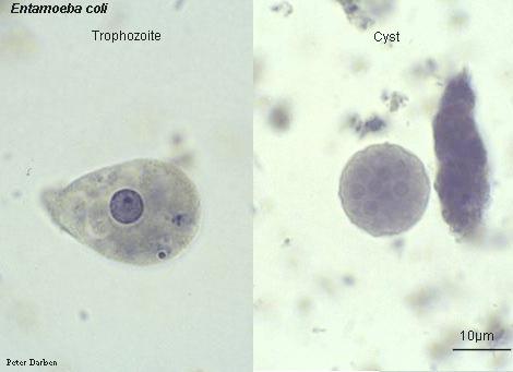  p>结肠内阿米巴(entamoeba coli grassi,1879)是人体肠道最常见的