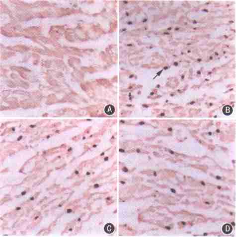  p data-id="gnwp7dfzcj">心肌细胞又称心肌纤维,有横纹,受 a target=