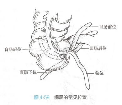 阑尾的常见位置