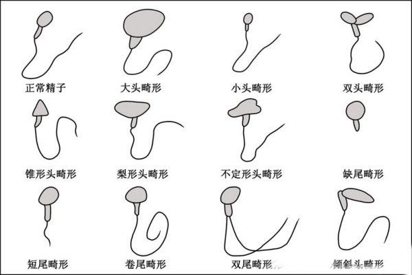 精子畸形率高