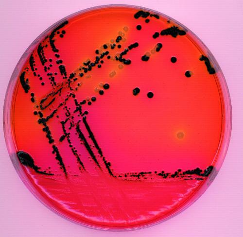  p>沙门菌是寄居在人类动物肠道内 a target="_bl