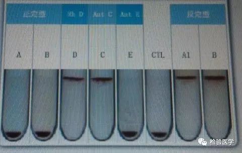 target="_blank" href="/item/交叉配血/8398604" data-lemmaid="