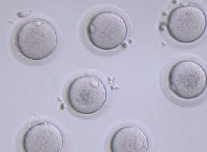  p>冷冻卵子,又称雪藏卵子,即取 a target="_bla