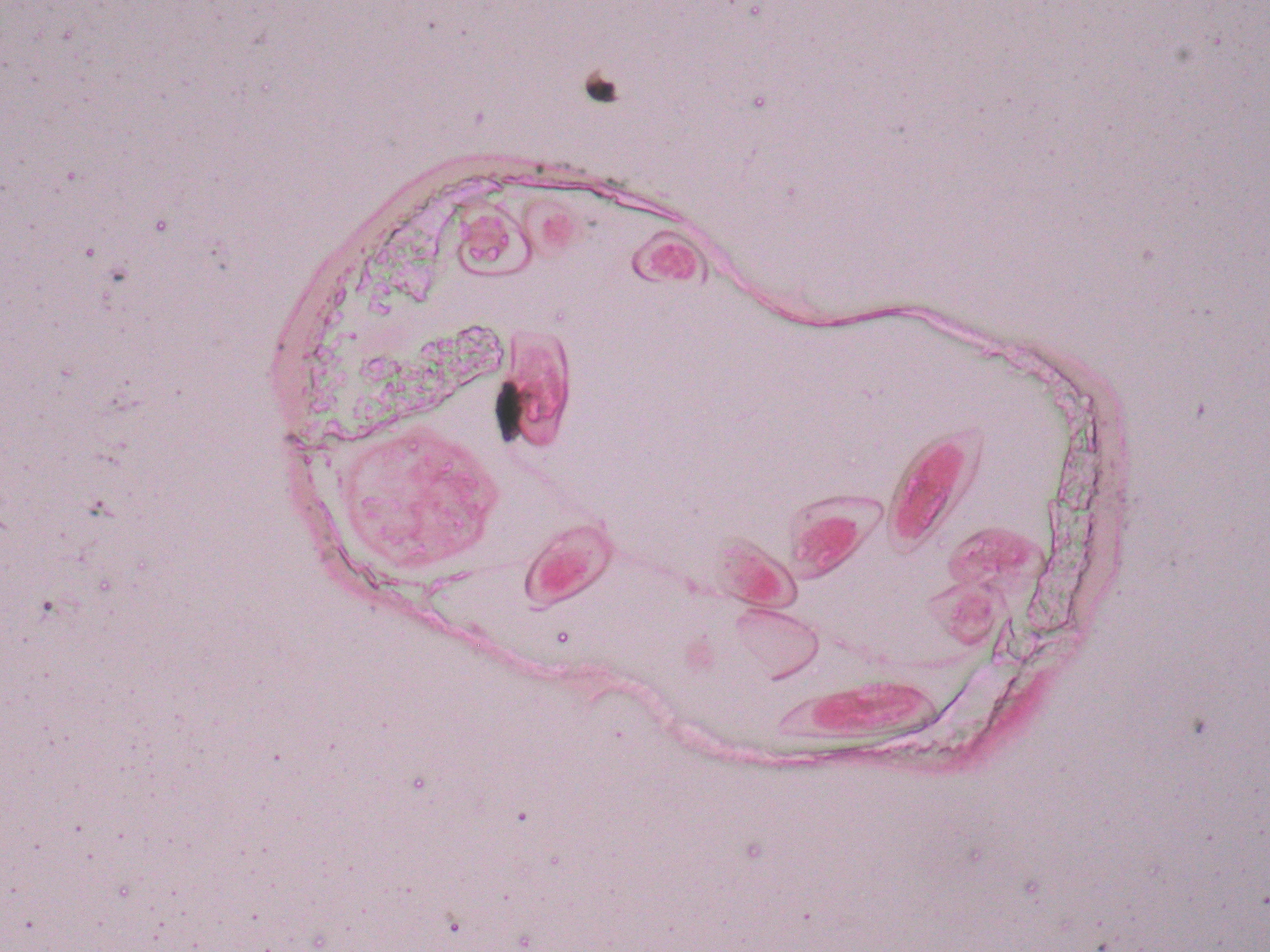  p>线虫动物门是动物界中最大的 a target="_blank" href="/item/门