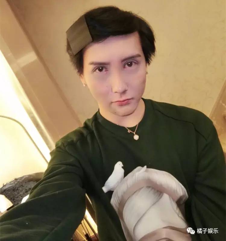 刘梓晨融掉全脸50多支玻尿酸，网友纷纷跪求请再打回去！_百科TA说