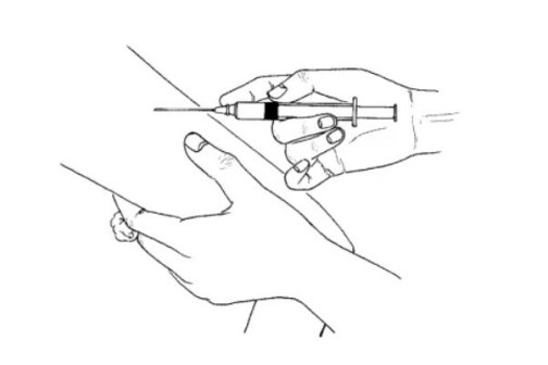 皮下注射法_百度百科