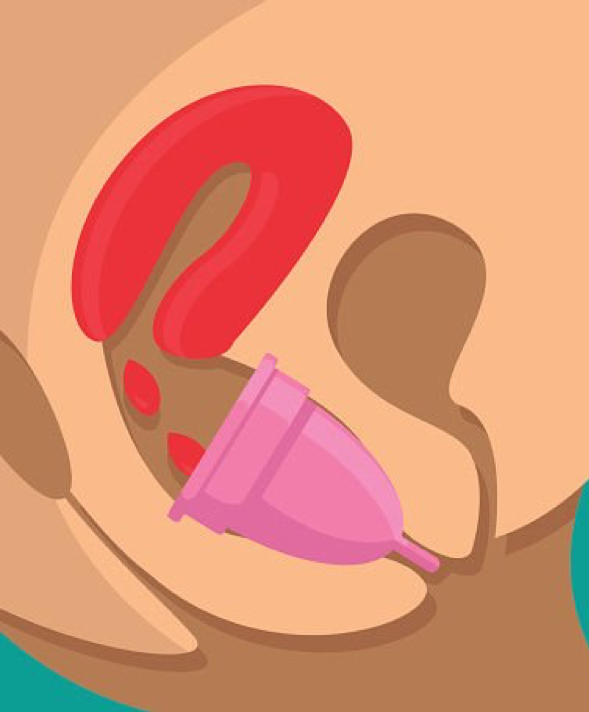  p>月经杯(menstrual cup)是放置于 a href="#" data-lemmaid="614136