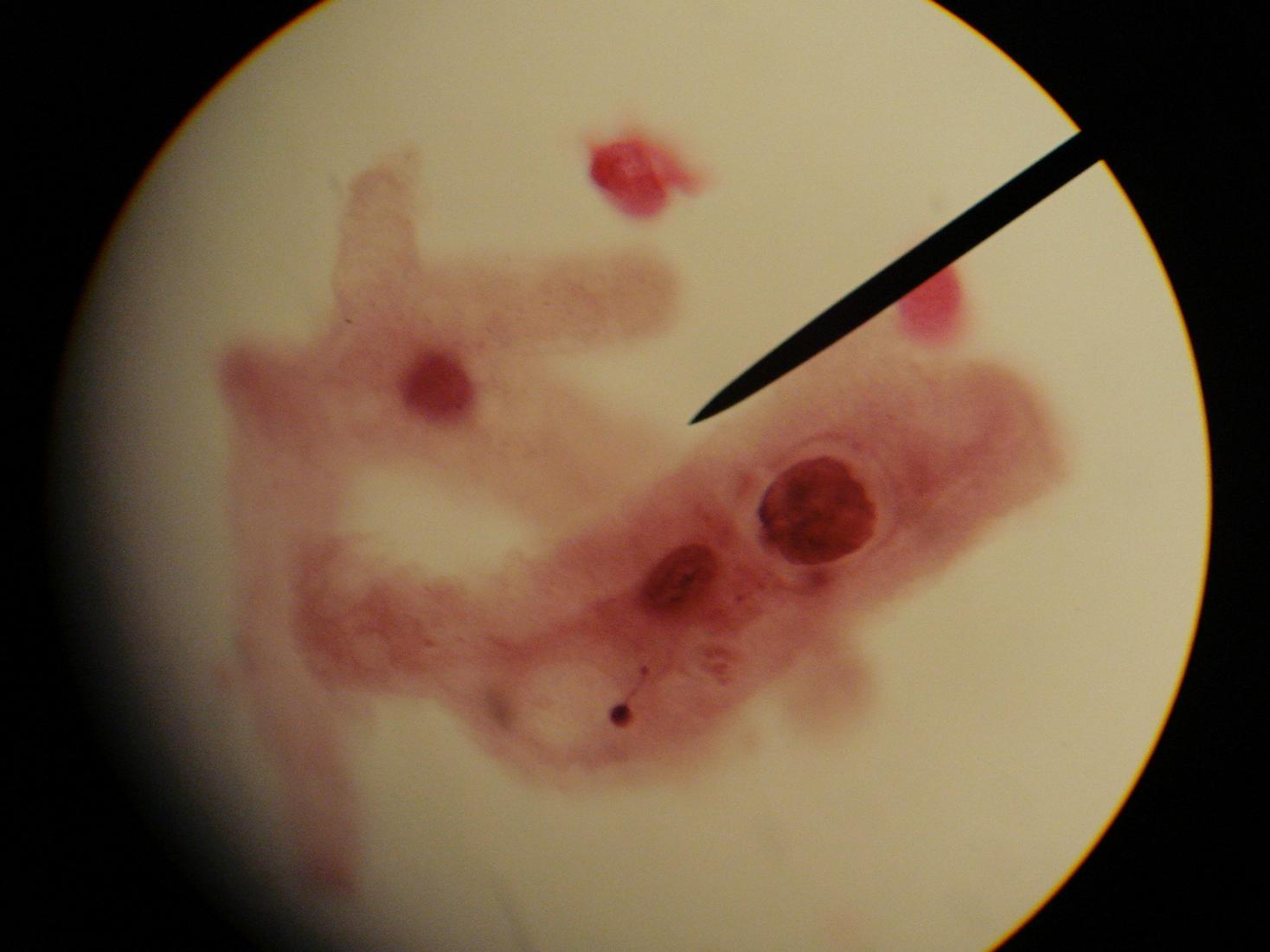  p>有成变形虫类,以伪足运动和摄食. /p>