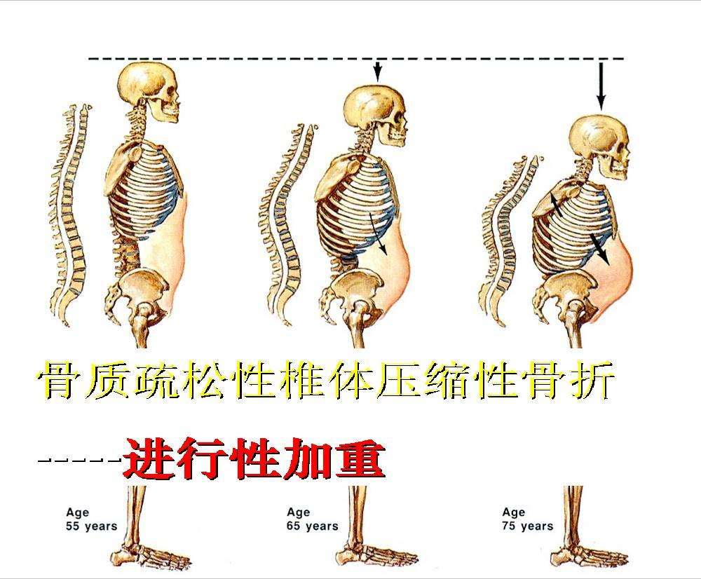  p data-id="gnfegnda8g">椎体 是椎骨负重的主要部分,呈短圆柱状