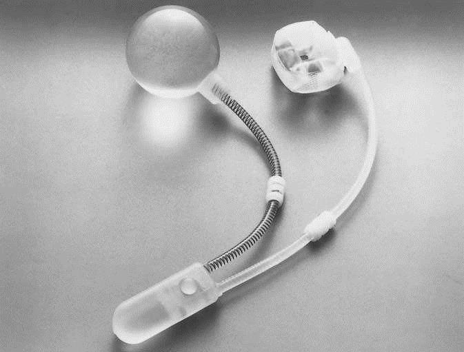 来控制尿道袖套的充胀和减胀,以达到控尿和排尿目的的植入性人工器官