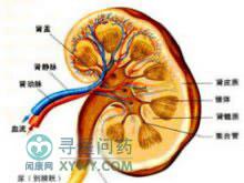 ="7253195">交叉异位肾 /a>与其对侧的正常肾脏相融合,而最常见于马蹄