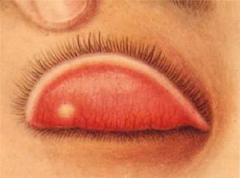  p>眼睑块 一种专门用_ l_描涂长睫毛上下边缘眼睑的粉状固体眼部化妆