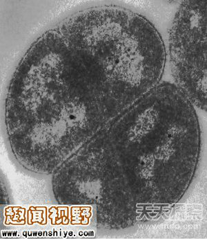 线虫名为"halicephalobus mephisto",以《浮士德》中描绘的恶魔