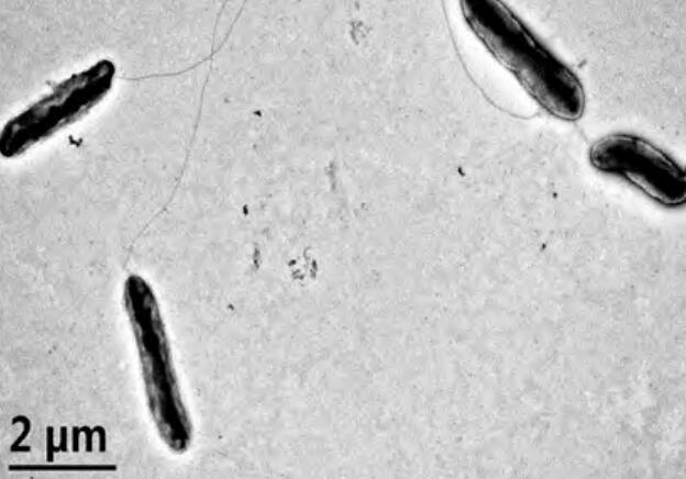 柠檬溃疡病是由野油菜黄单孢菌柑橘致病