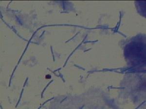  p>口腔纤毛菌属 a target="_blank" href="/item/厌氧菌/93176" data