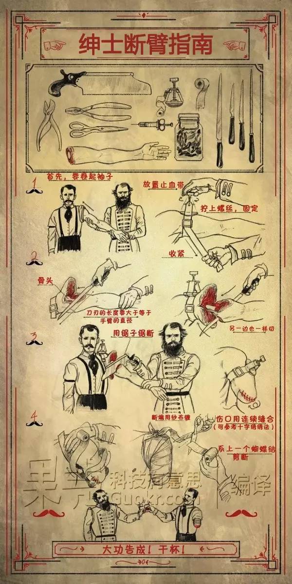 李斯顿以其在麻醉剂出现之前的纯熟手术技巧而闻名. /p>