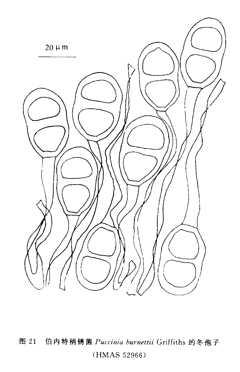  p data-id="gnx8xquf0o">冬孢子堆生于叶上面, a target="_blank"