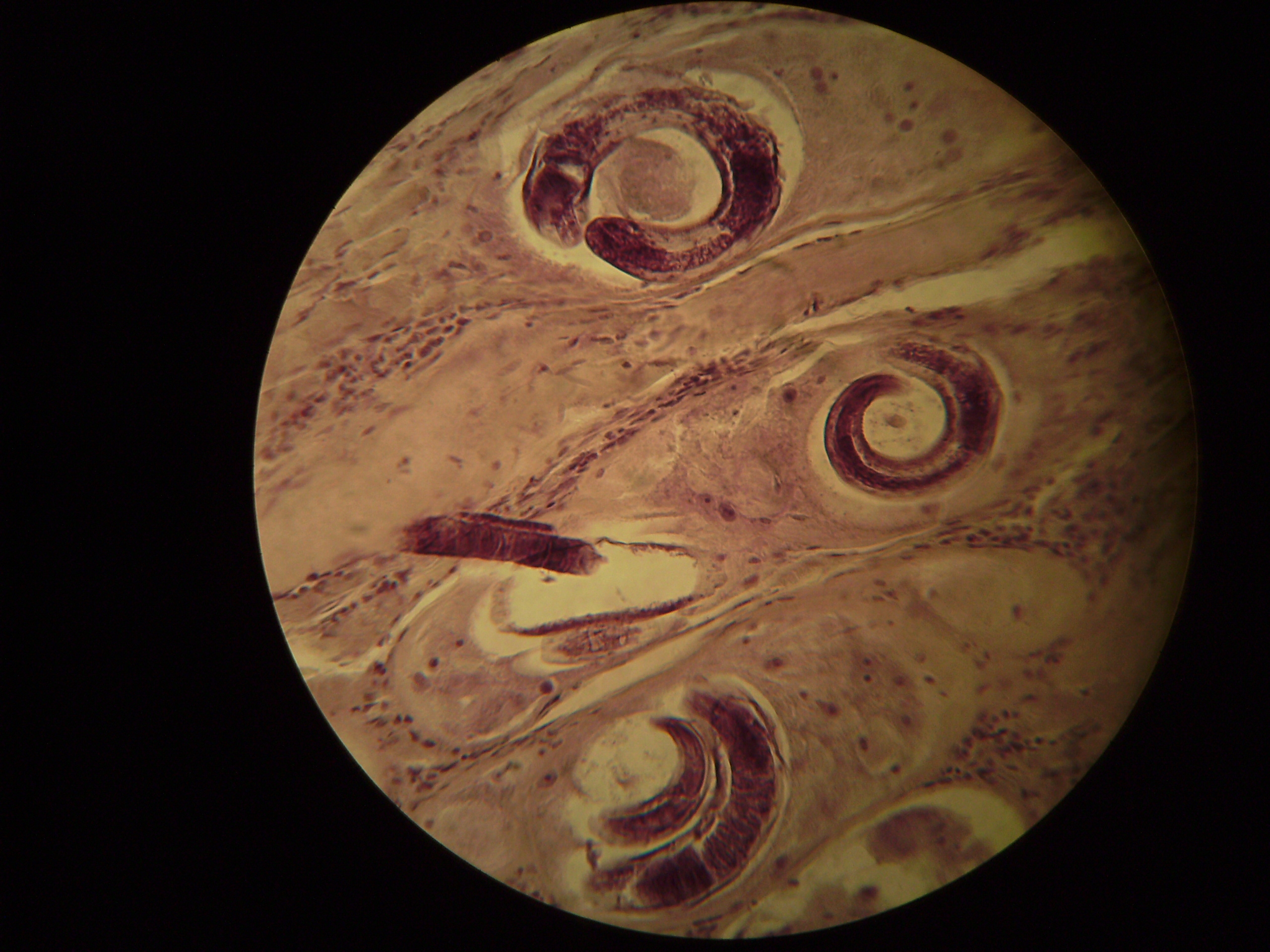  p>旋毛虫 a href="#" data-lemmaid="2697752">幼虫寄生 /a>于肌纤维