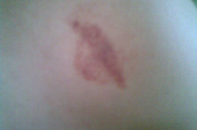  p>吻痕,唇的印记.