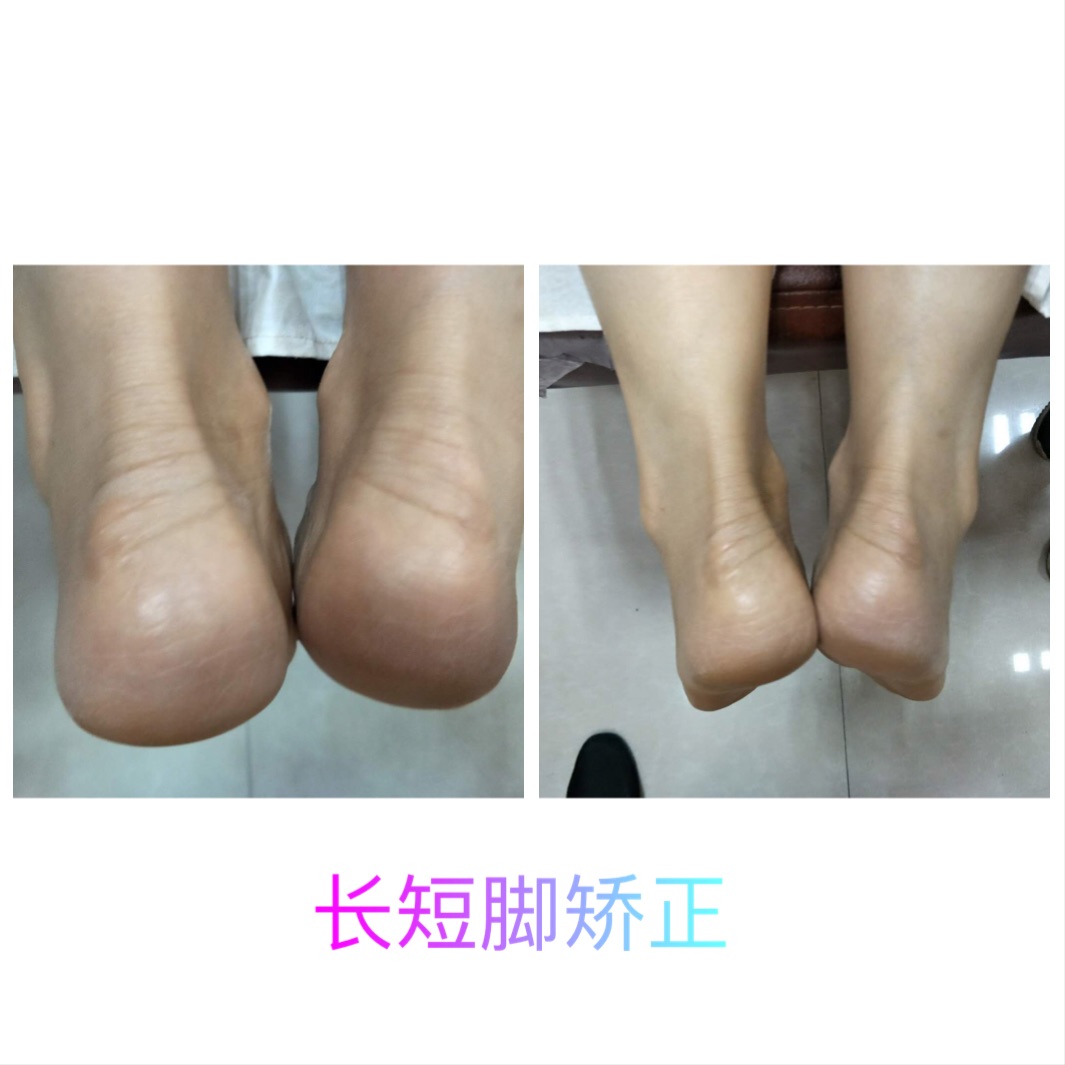 长短脚