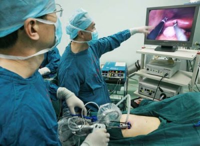 宫腔镜微创手术