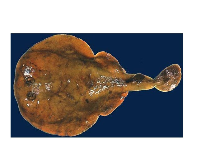  p>单鳍电鳐科, i>narkidae  /i>(fowler, 1934),软骨鱼纲 a target="