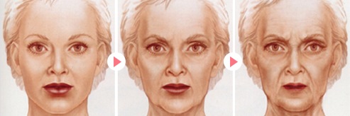 鸡皮肤会加速衰老吗(鸡皮肤会随着年纪改善吗)