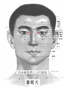目内眦穴