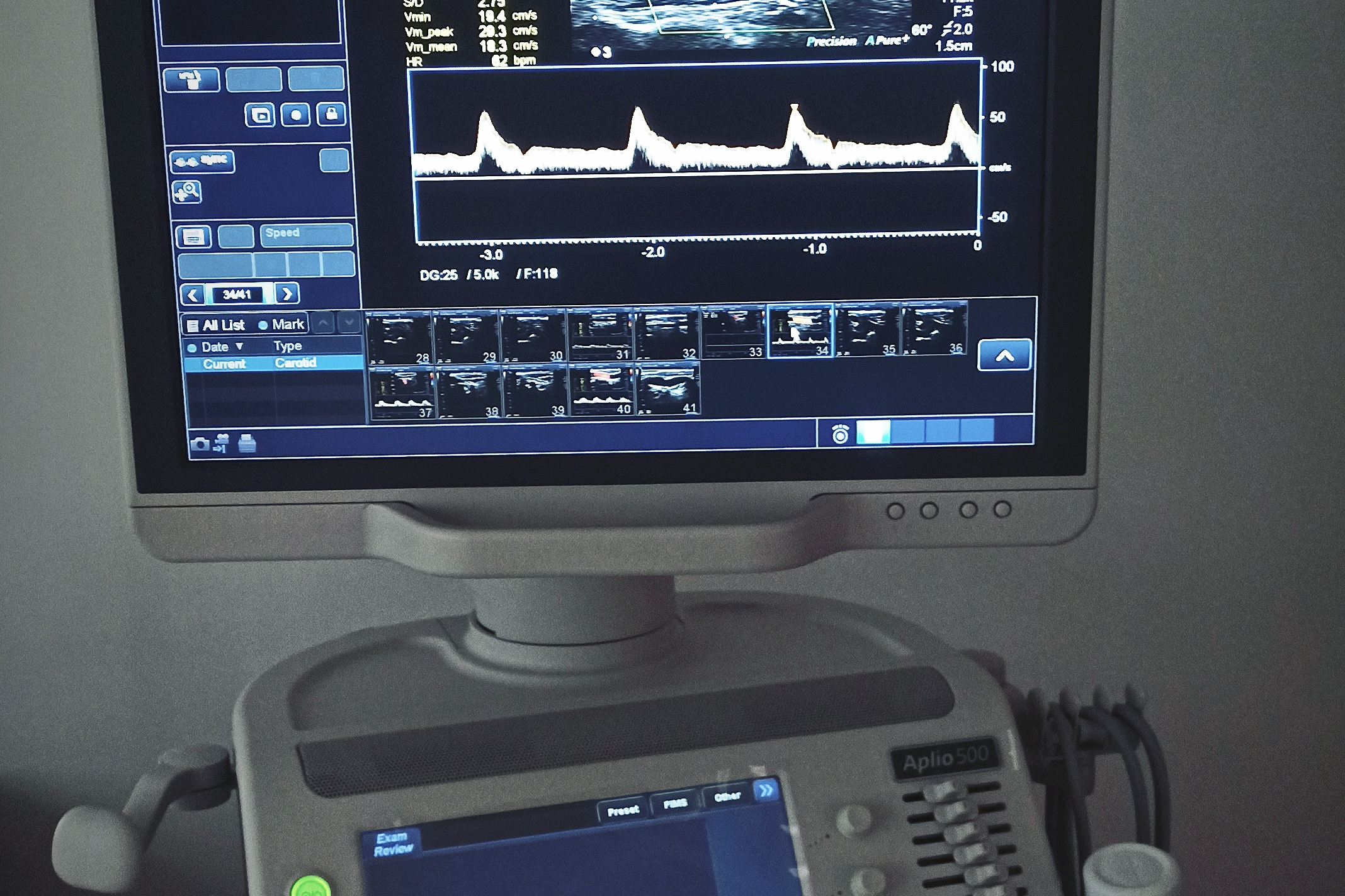  p>彩色多普勒超声又称彩超,是一种医用设备,适用于全身各部位脏器