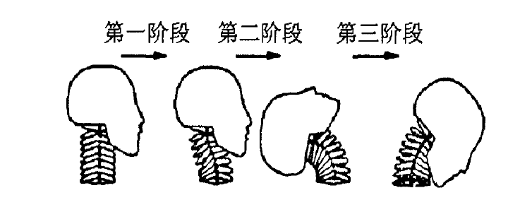 挥鞭伤_百度百科